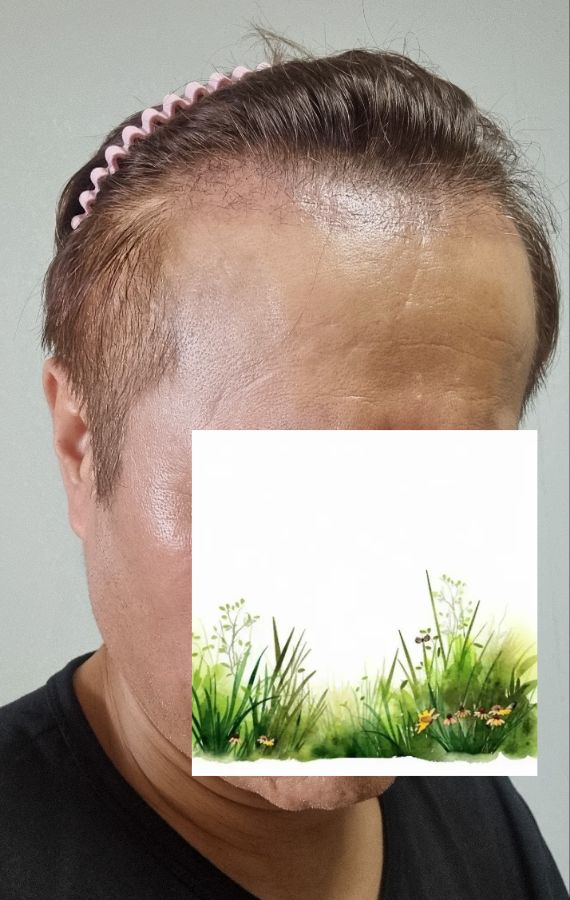 000.jpg
