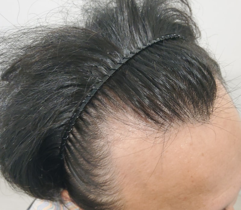 1. 수술전_3.jpg