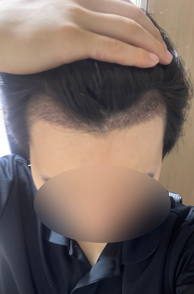 10g1.jpg
