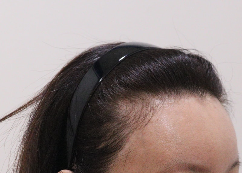 1. 수술전_3.JPG