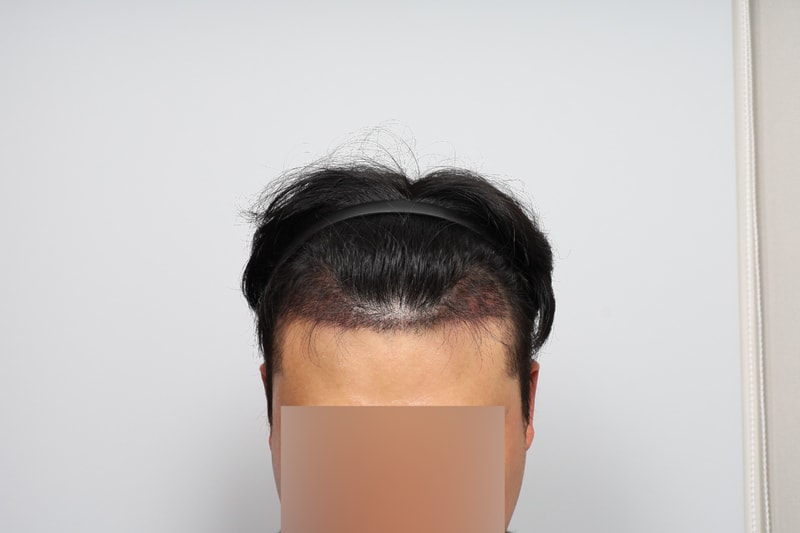 2025110811455446010.jpg