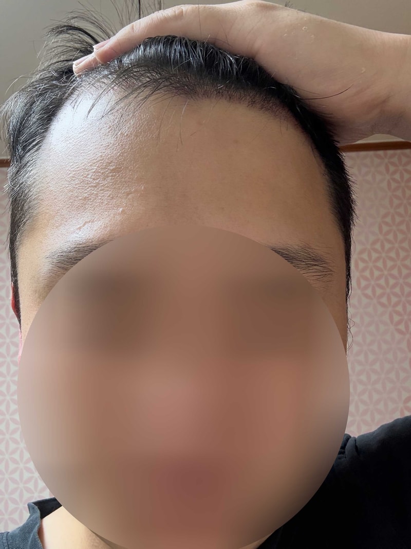 내머리.jpg