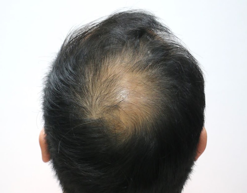 1.수술전.JPG