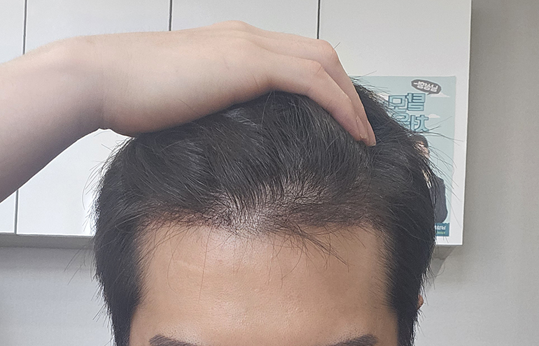 5- 까실까실 귀여운녀석들ㅋㅋ곧 빠지겠지요.jpg