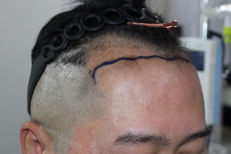 1000046706.jpg