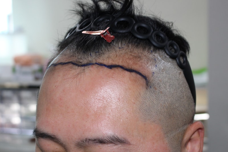 1000046707.jpg