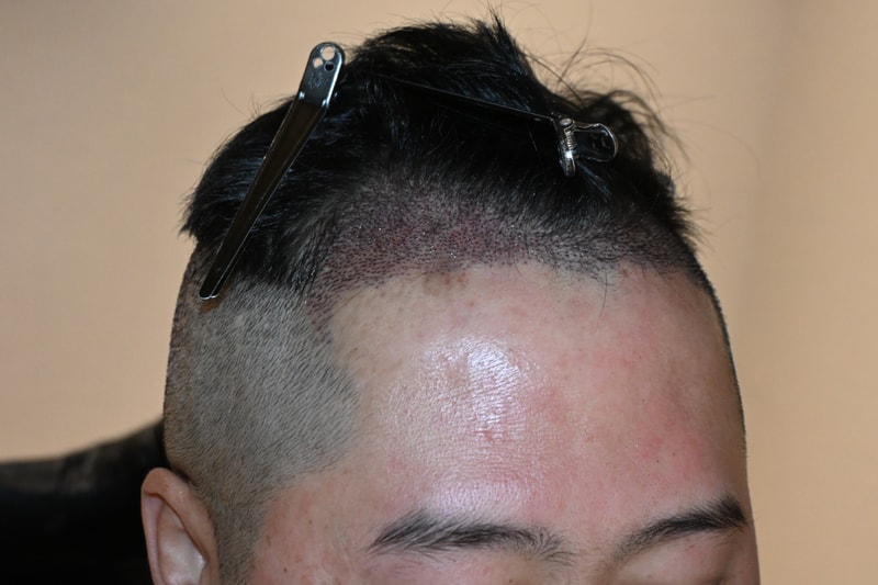 1000046712.jpg