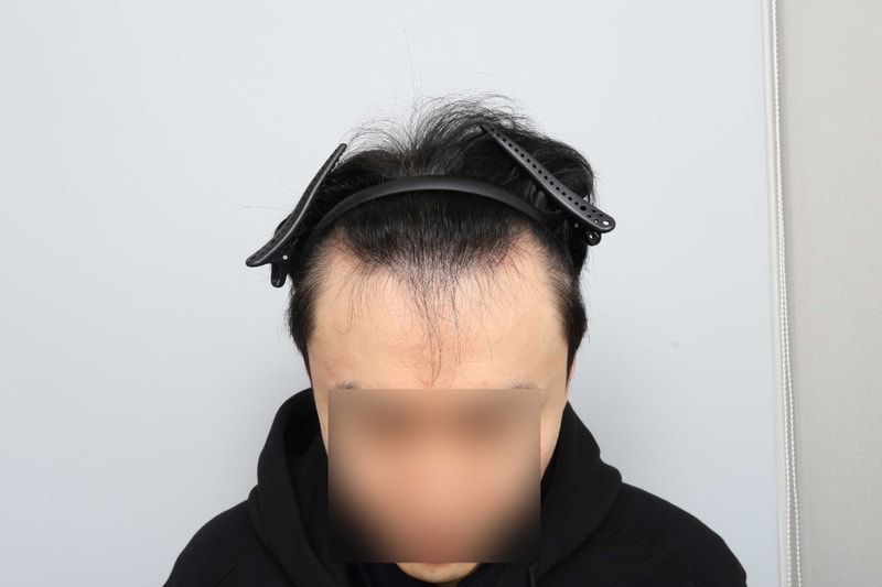 수술전-(15).jpg