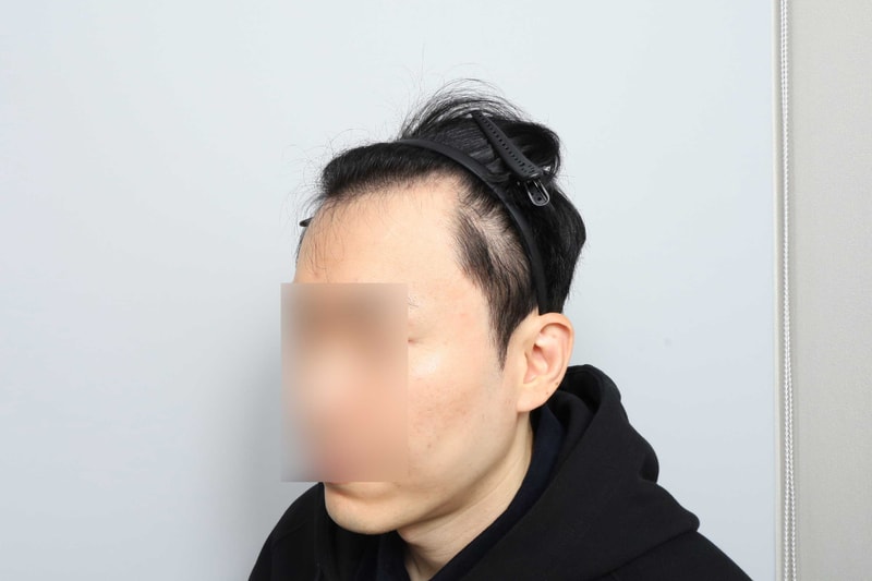 수술전-(18).jpg