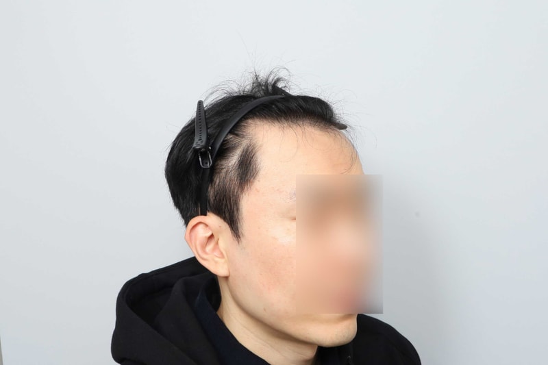수술전-(23).jpg
