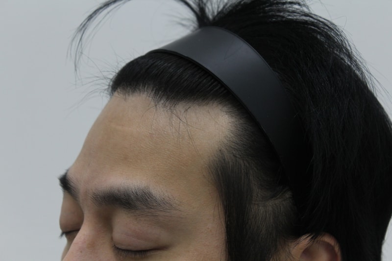 수술전 (1).JPG