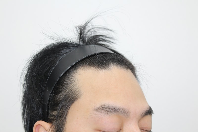 수술전 (5).JPG