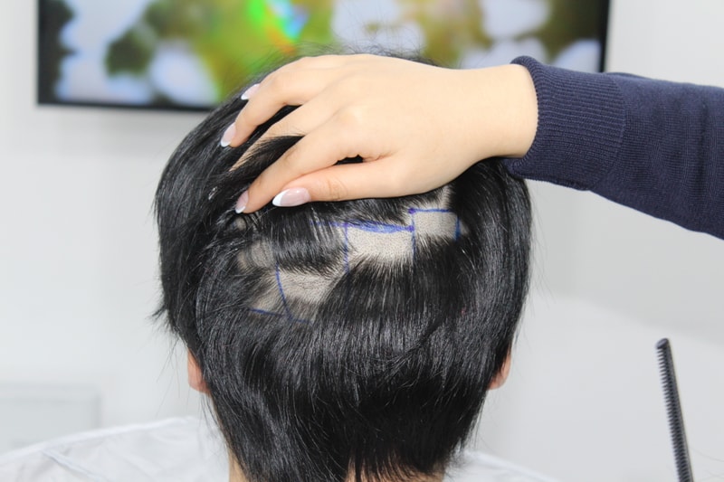 수술전디자인 (14).JPG