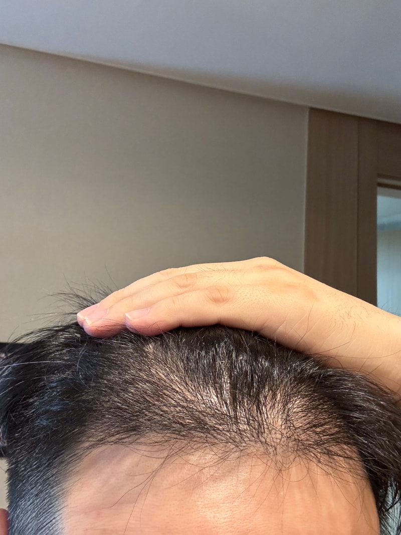 6개월차 후기입니다.