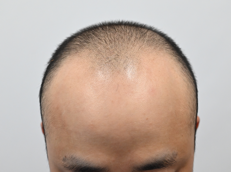 초진사진4.png