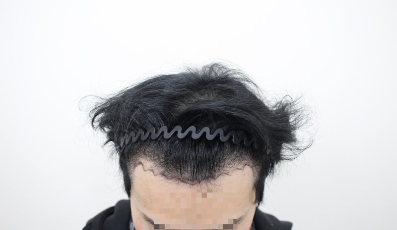 1000039572.jpg