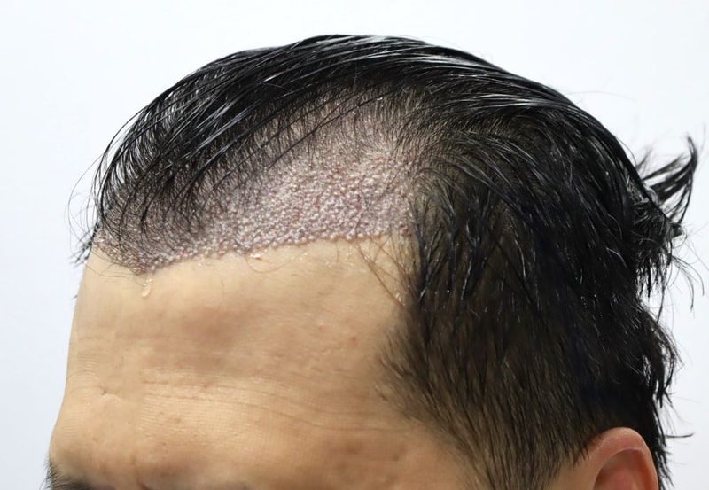 06.수술당일.JPG