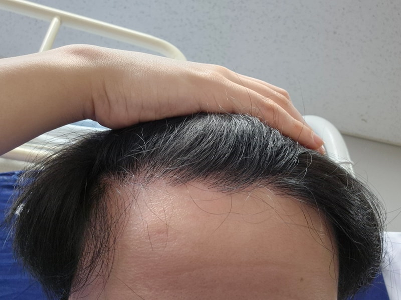 7달차. 경과입니다.