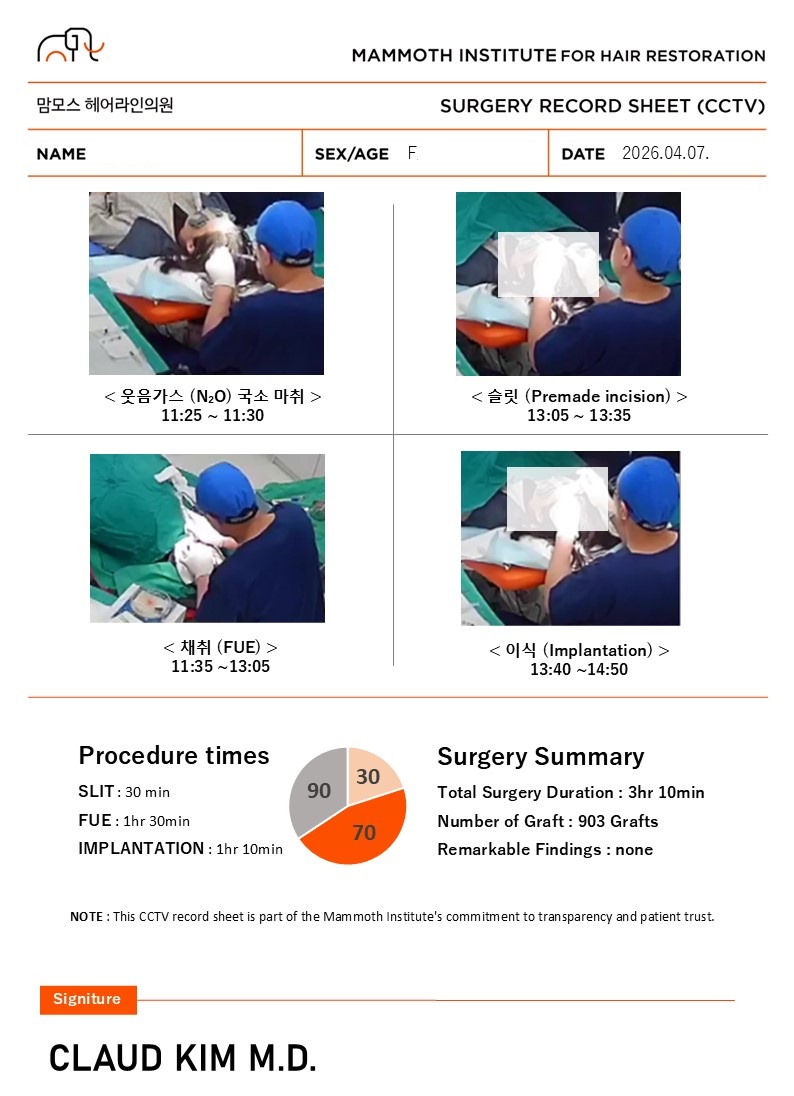 부산 맘모스 여자 정수리 모발이식 당일 후기