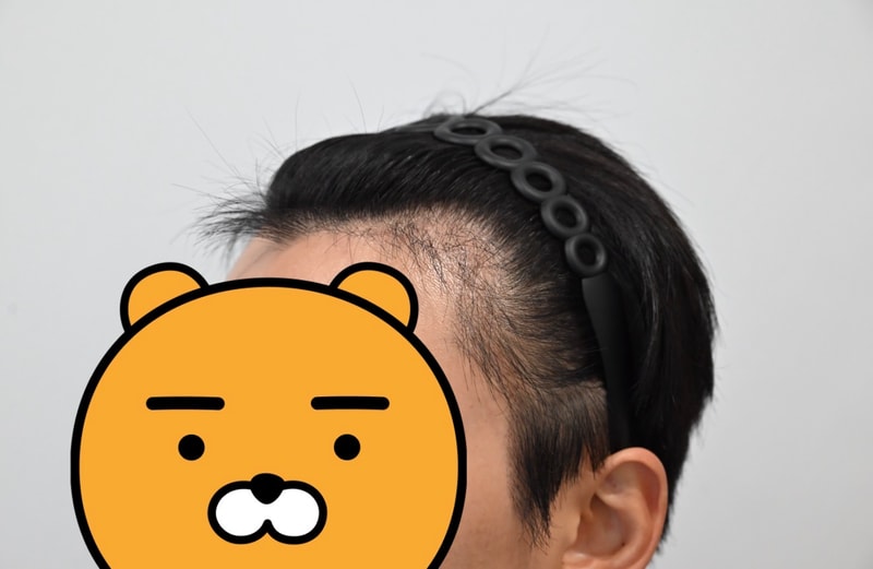 3개월차 후기 남겨드립니다.