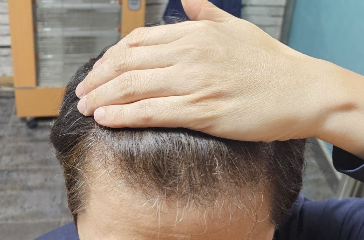 머리가없었다.jpg