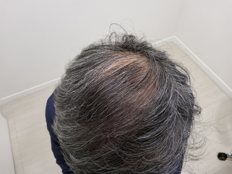 4. 수술후_1년_4.jpg