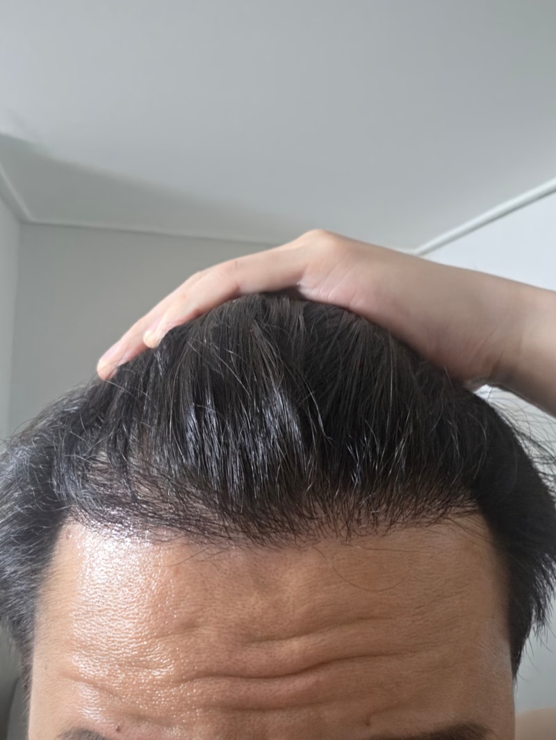 6개월차