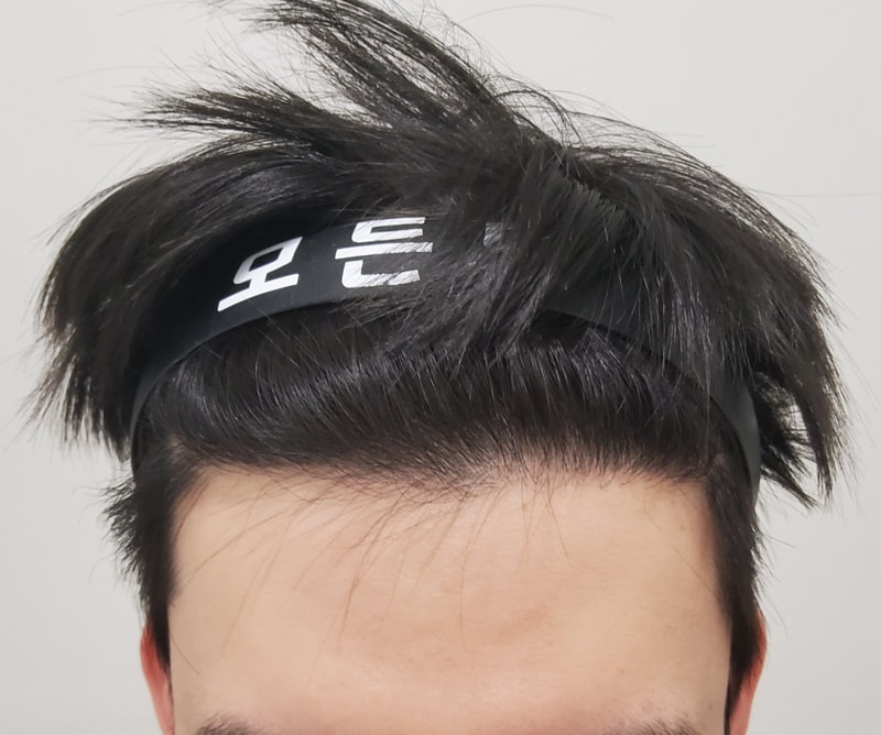 4. 수술후_1년_1.jpg