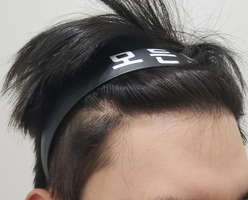 4. 수술후_1년_3.jpg