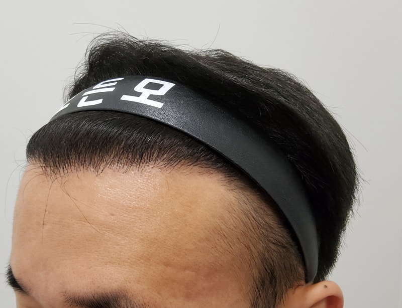 5. 수술후_1년_2.jpg