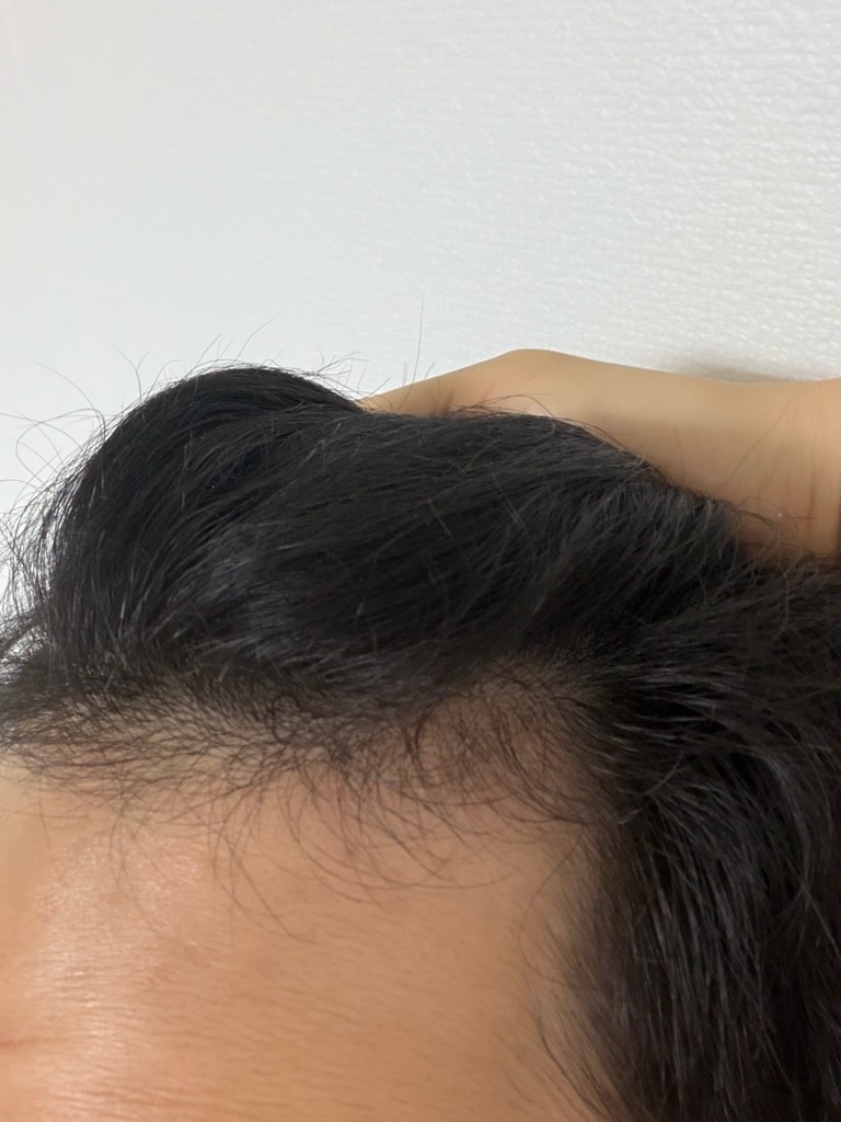 후.jpg