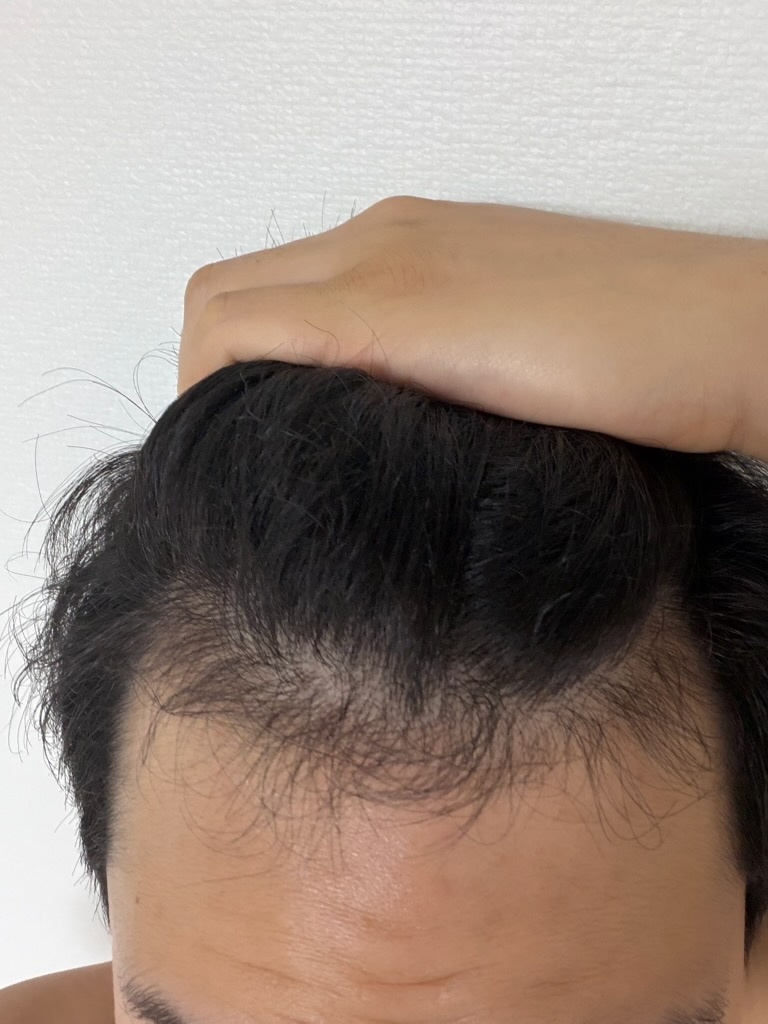후3.jpg