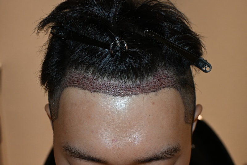 KakaoTalk_20260418_174411897_03.jpg