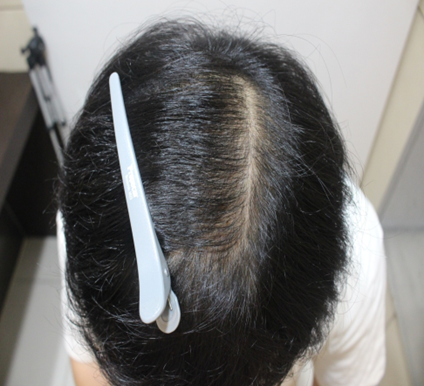 KakaoTalk_20260423_165011313_01 (1).png