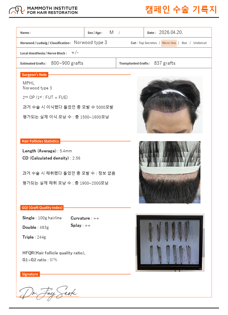 압구정 맘모스 모발수 부풀리기 근절캠페인 재수술 당일후기
