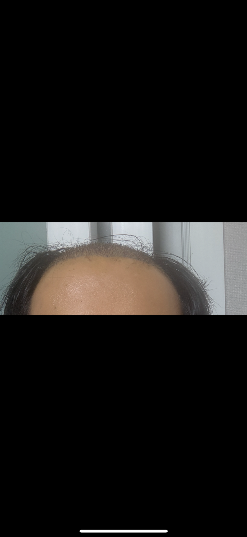 헤이아치 소생기 일주일차