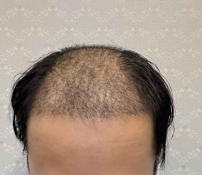 헤이아치 소생기 한달차