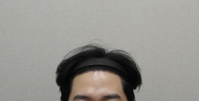 3. 최근 경과보러 방문했을 때 찍은 사진입니다.JPG