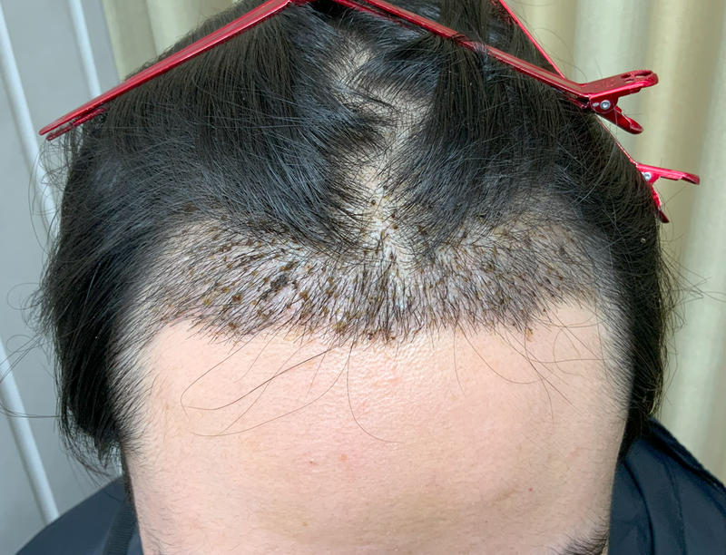 지병오95 2500모 14일 패드.png