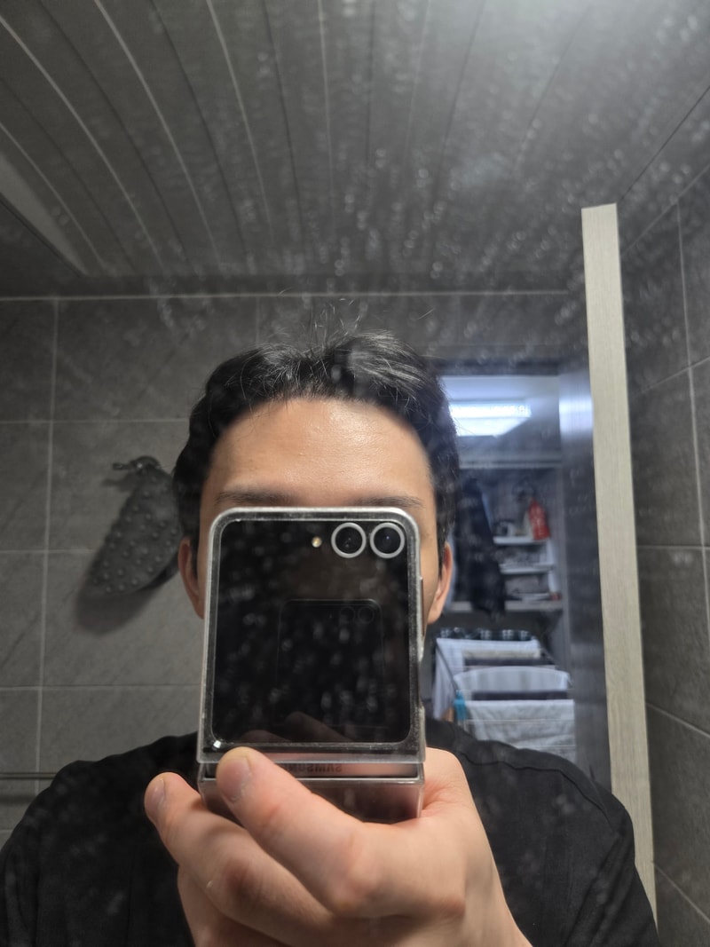 뉴헤어 모발이식 비절개 3400모 7개월차 후기