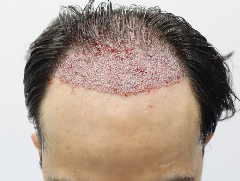 06.수술당일.JPG