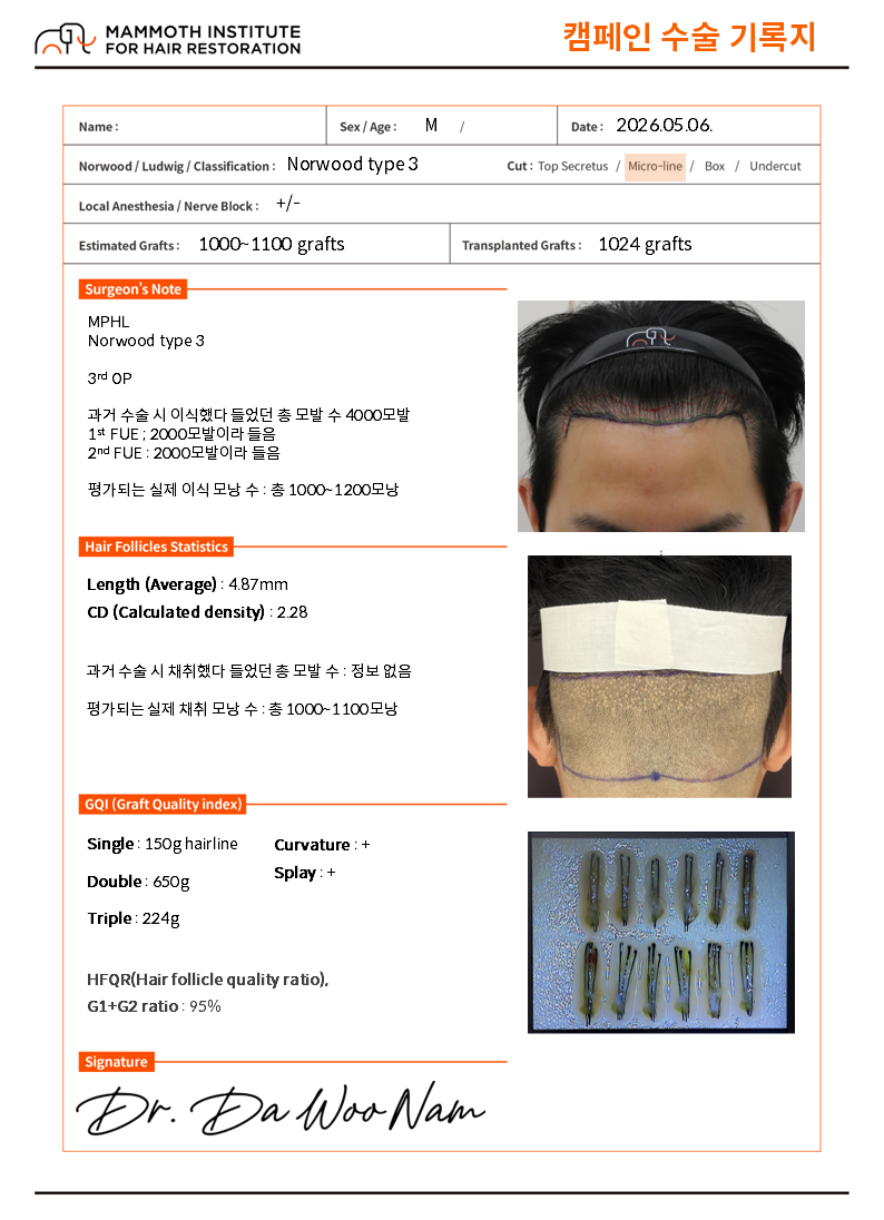 인천 맘모스헤어라인 의원 모발수 책정 근절, 무료 재수술 캠페인 수술 후기
