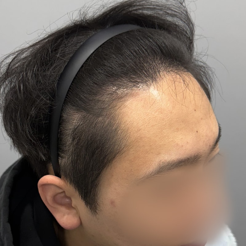 수술 전 (2).jpg