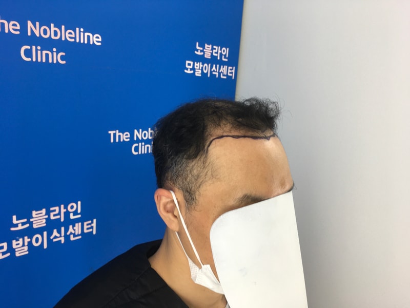 もう少し髪がダウンしてきましたね