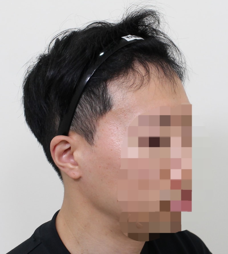6개월차(측면).jpg