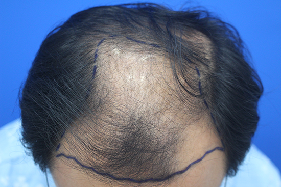 2.JPG