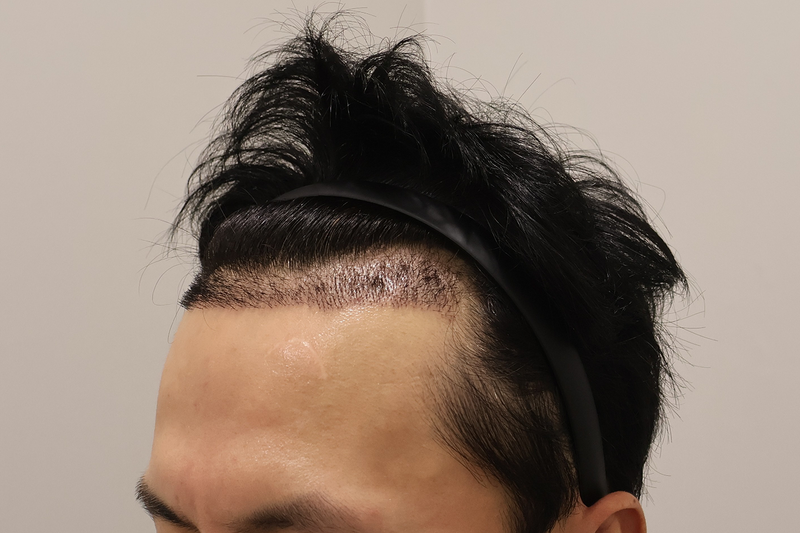 3.png
