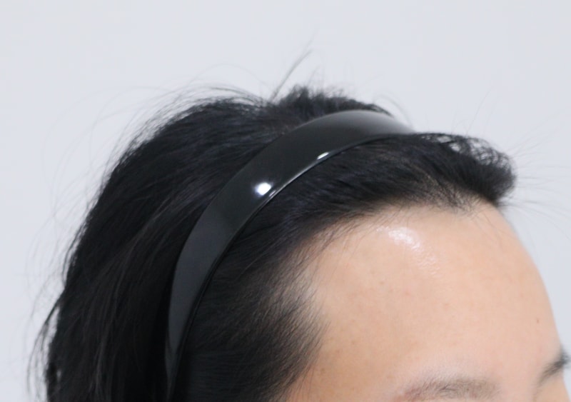 1. 수술전_3.JPG
