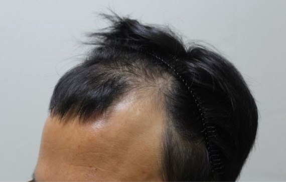 [크기변환]수술전2.JPG