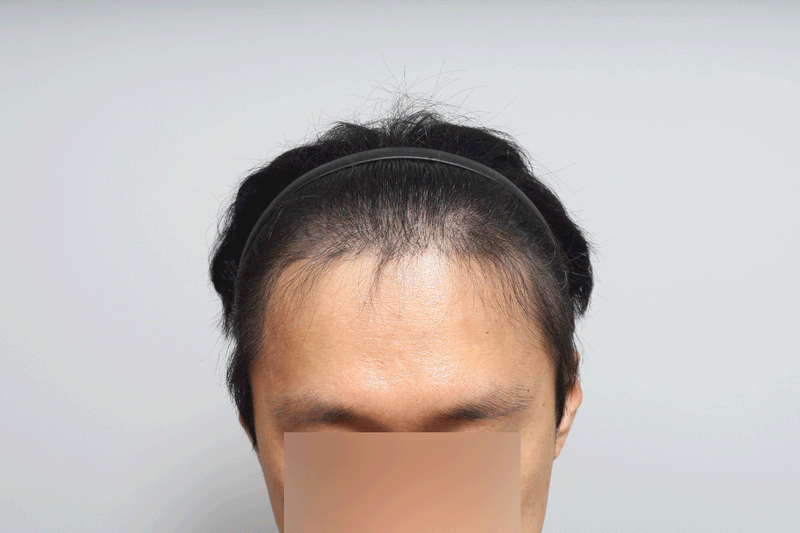 w1.gif